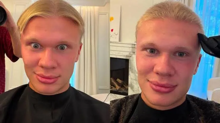 ¡Adiós a la melena! Haaland sorprende con radical cambio de look