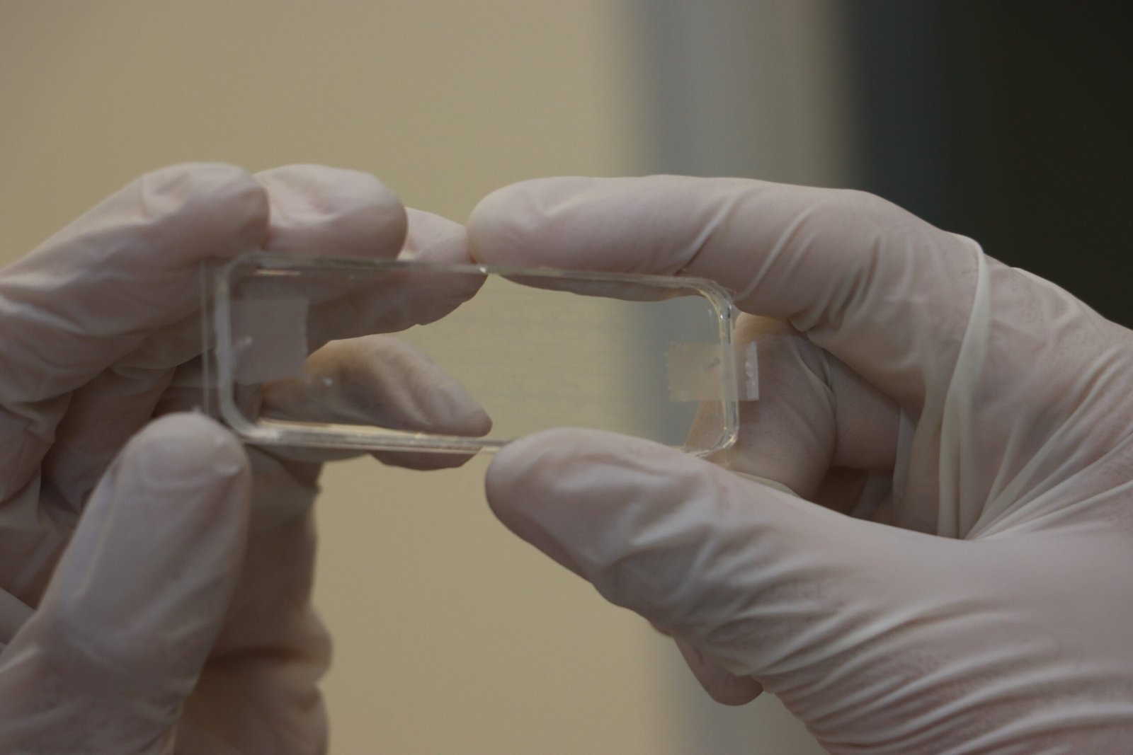 Alumnos desarrollan dispositivos para el diagnóstico oportuno de cáncer gástrico en el HRAEPY