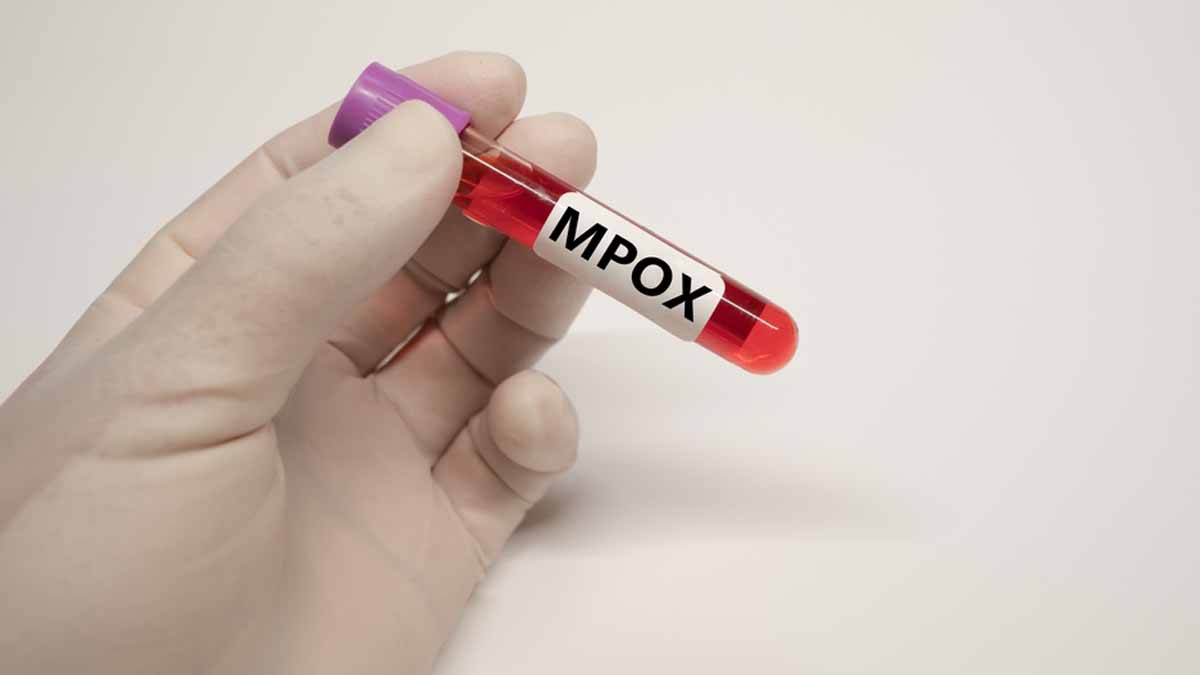 OMS advierte sobre la posibilidad de nuevos brotes de Mpox en Europa tras caso detectado en Suecia