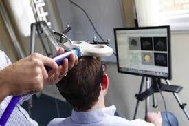 Estimulación Magnética Transcraneal (EMT) como tratamiento de la enfermedad de Parkinson (EP)
